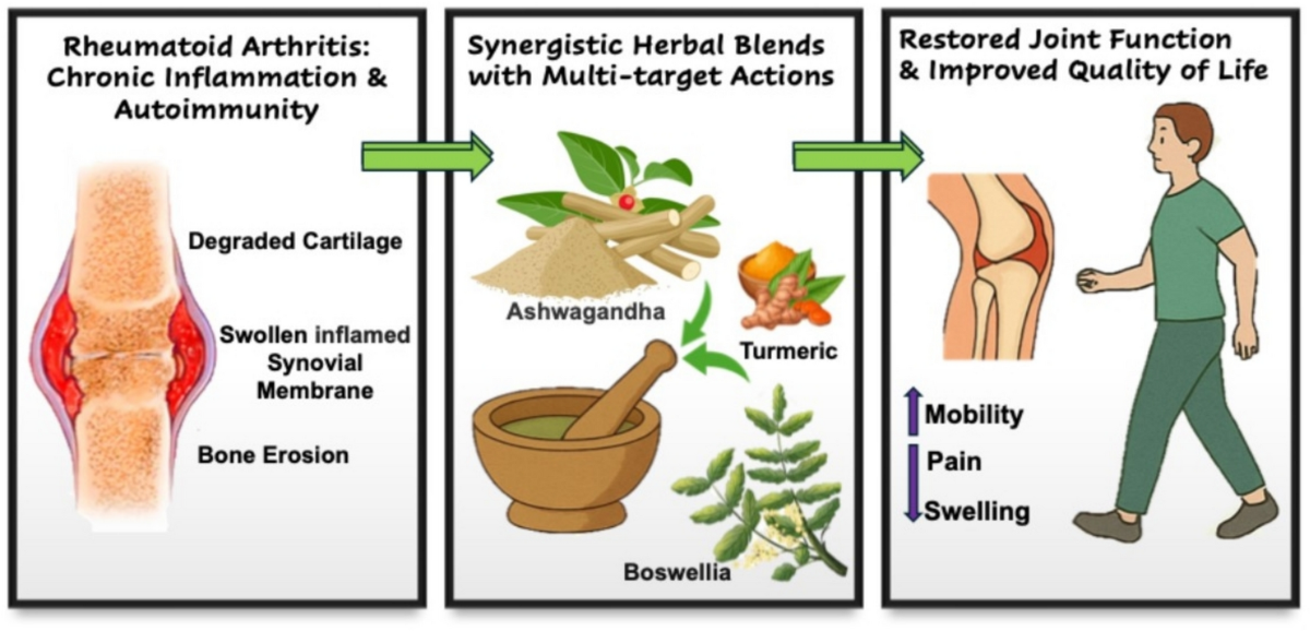 glutathione joint pain Exploring herbal synergies in the management of rheumatoid arthritis: a  multifaceted approach to inflammation and joint health |  Inflammopharmacology