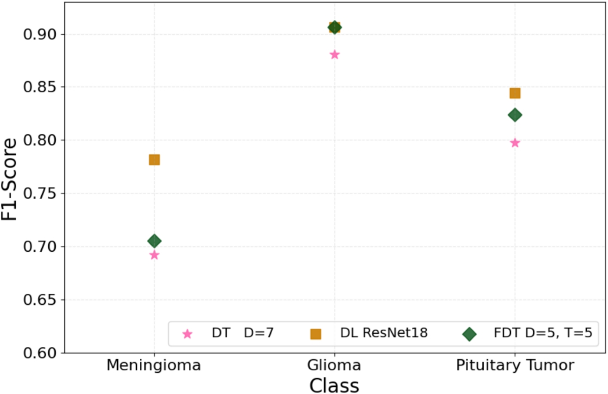 Fuzzy Decision Trees for Explainable Brain Tumor Classification: A  Comparative Study with Deep Neural Networks and Classical Binary Decision  Trees | Information Systems Frontiers | Springer Nature Link