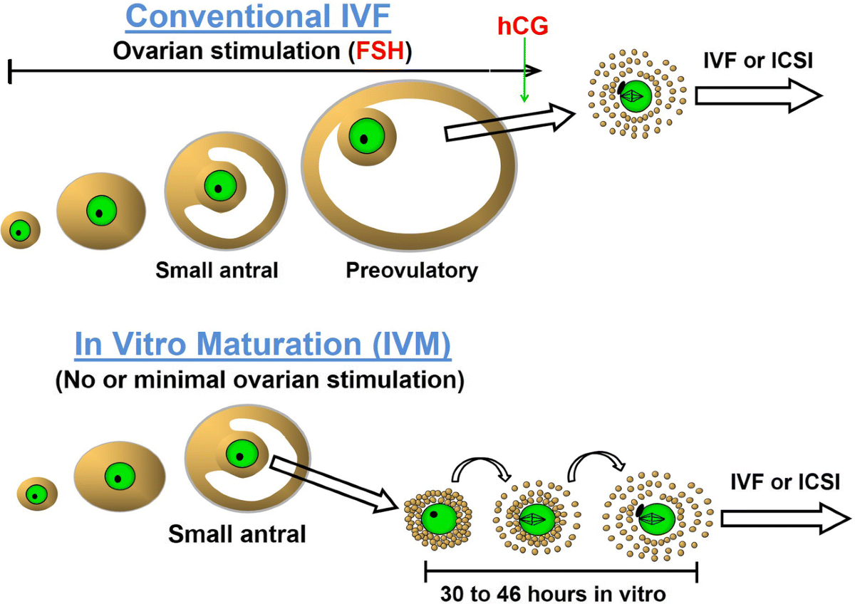 Perspectives on the development and future of oocyte IVM in ...