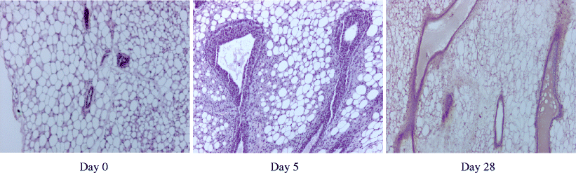 IGF I GH and Sex Steroid Effects in Normal Mammary Gland  