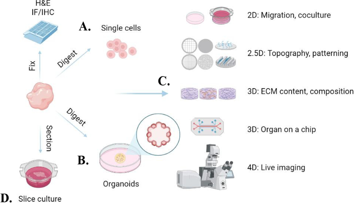 Gestational Breast Cancer – a Review of Outcomes, Pathophysiology, and  Model Systems | Journal of Mammary Gland Biology and Neoplasia