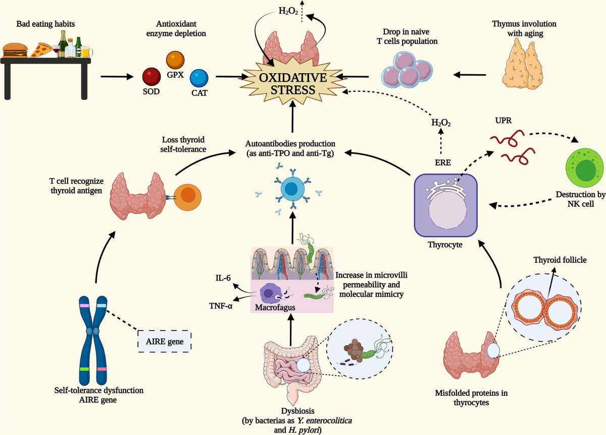 glutathione and hashimoto Multiple nutritional factors and thyroid disease, with particular reference  to autoimmune thyroid disease | Proceedings of the Nutrition Society main image 1