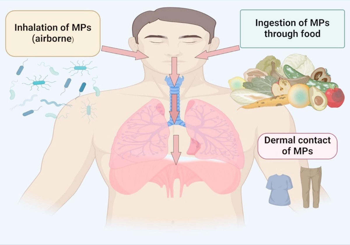 Do microplastics play a role in the pathogenesis of neurodegenerative diseases? Shared pathophysiological pathways for Alzheimer's and Parkinson's disease | Molecular and Cellular Biochemistry | Springer Nature Link Do microplastics play a role in the pathogenesis of neurodegenerative diseases? Shared pathophysiological pathways for Alzheimer's and Parkinson's disease | Molecular and Cellular Biochemistry | Springer Nature Link