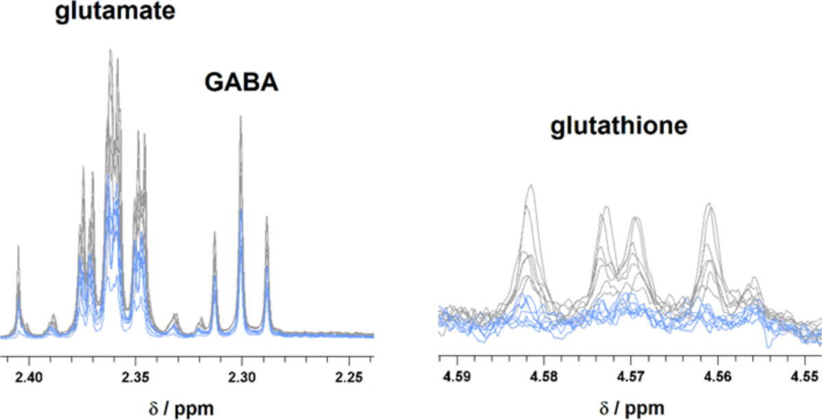 glutathione athletic performance Glutathione vs Astaxanthin: Which Is Better? glutathione athletic performance Glutathione vs Astaxanthin: Which Is Better?