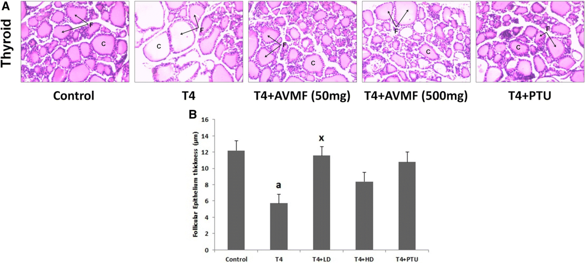 Ameliorative effect of Aloe gel against L-T4-induced hyperthyroidism via  suppression of thyrotropin receptors, inflammation and oxidative stress |  Molecular Biology Reports | Springer Nature Link