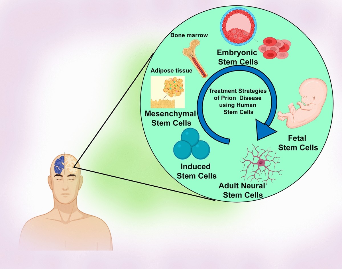 A review on current theories and potential therapies for prion diseases |  Molecular Biology Reports | Springer Nature Link