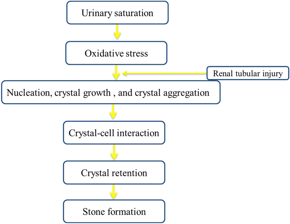 kidney stones natural treatment olive oil