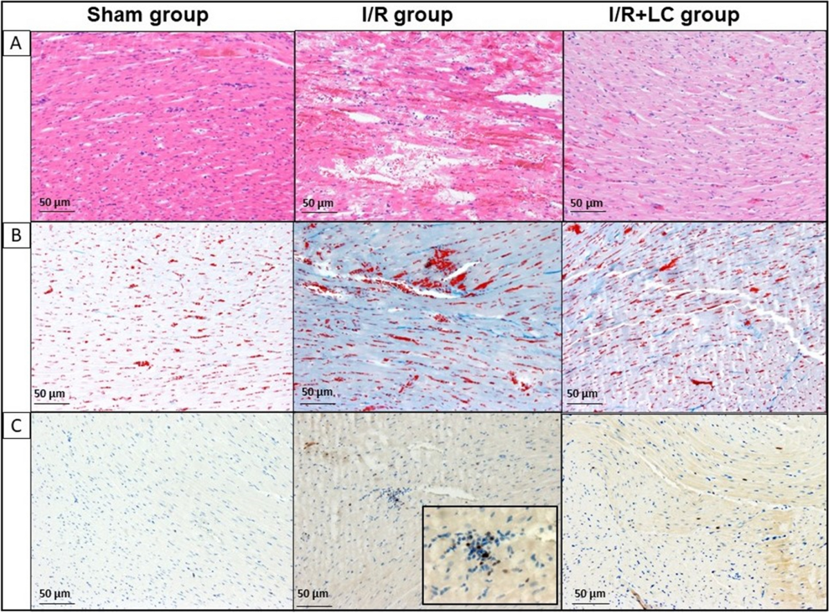 l carnitine for myocarditis Potential protective effects of L-carnitine against myocardial ischemia/reperfusion injury in a rat model | Environmental Science and Pollution Research