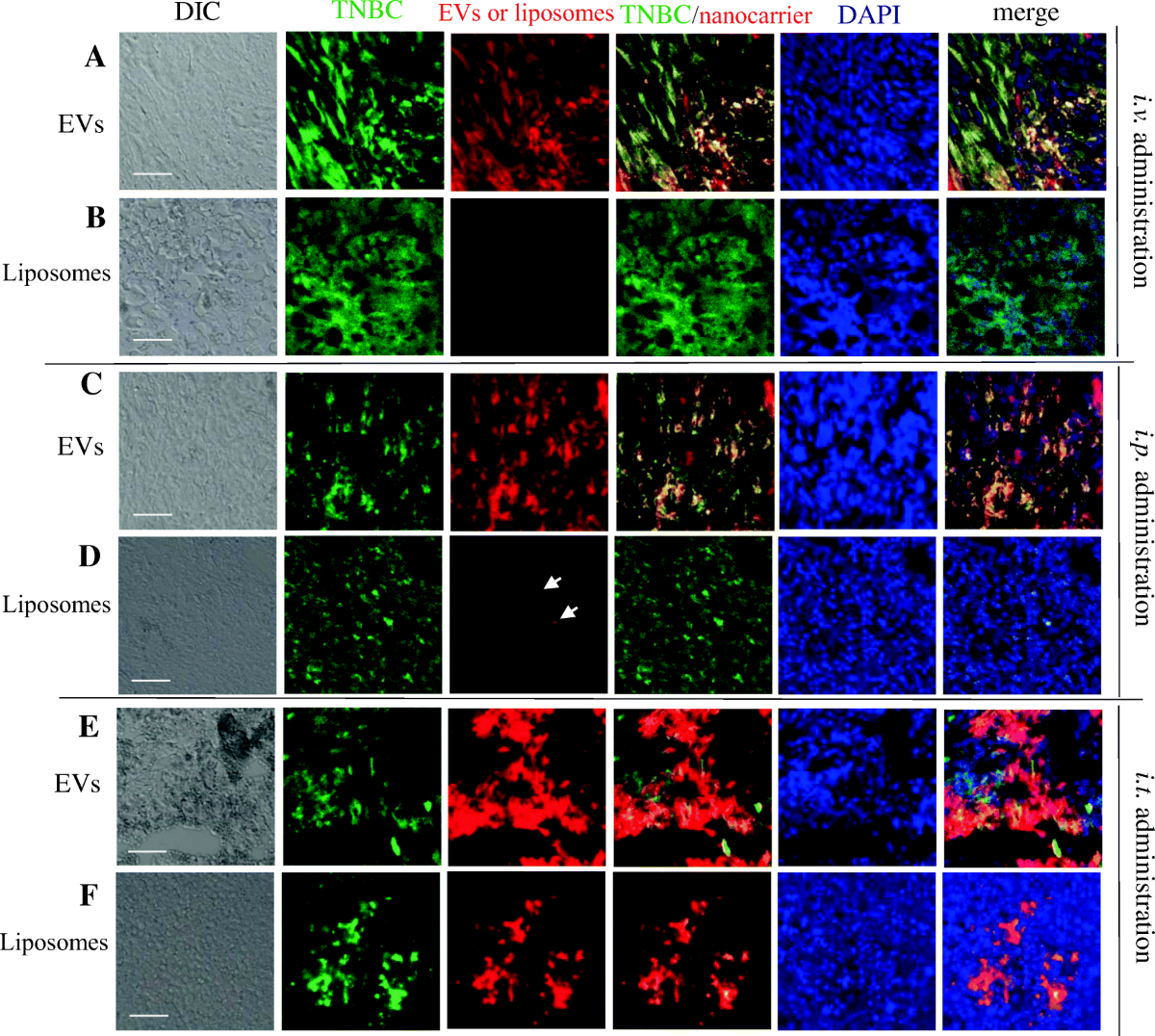 Macrophage-Derived Extracellular Vesicles as Drug Delivery Systems for  Triple Negative Breast Cancer (TNBC) Therapy | Journal of Neuroimmune  Pharmacology