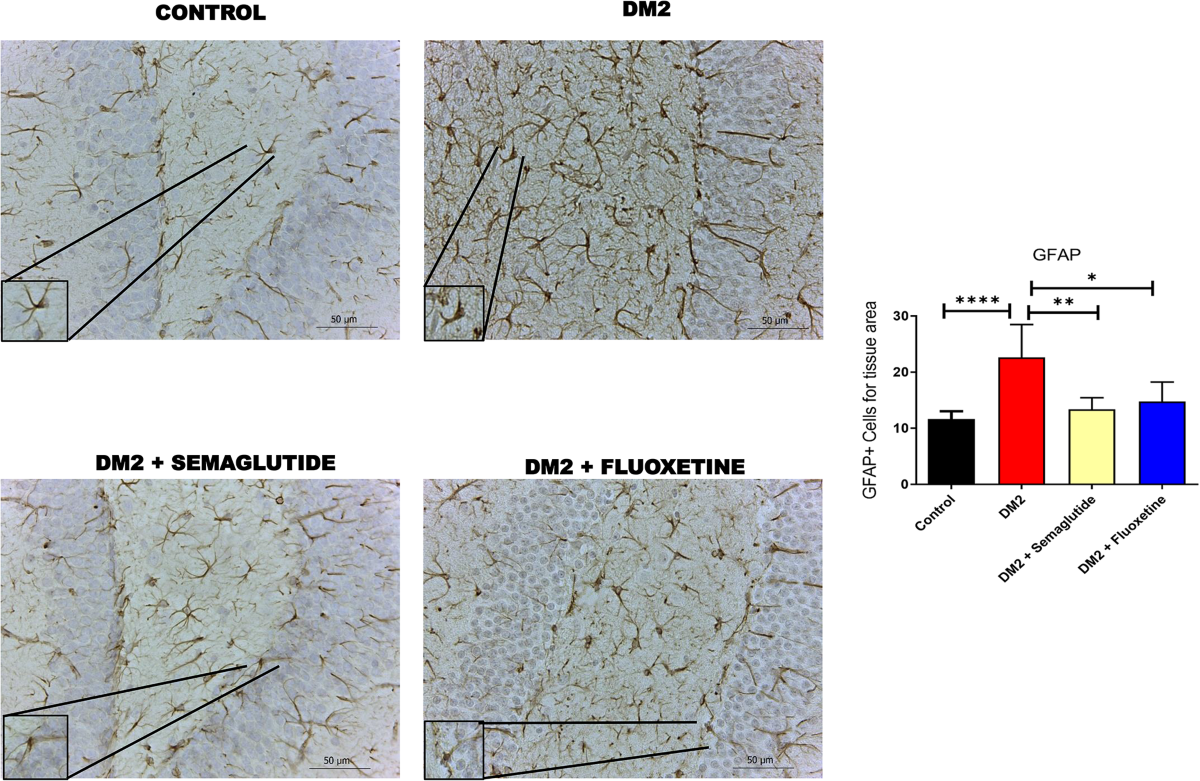 semaglutide face aging Ozempic Face Before and After Examples of Facial Volume Loss