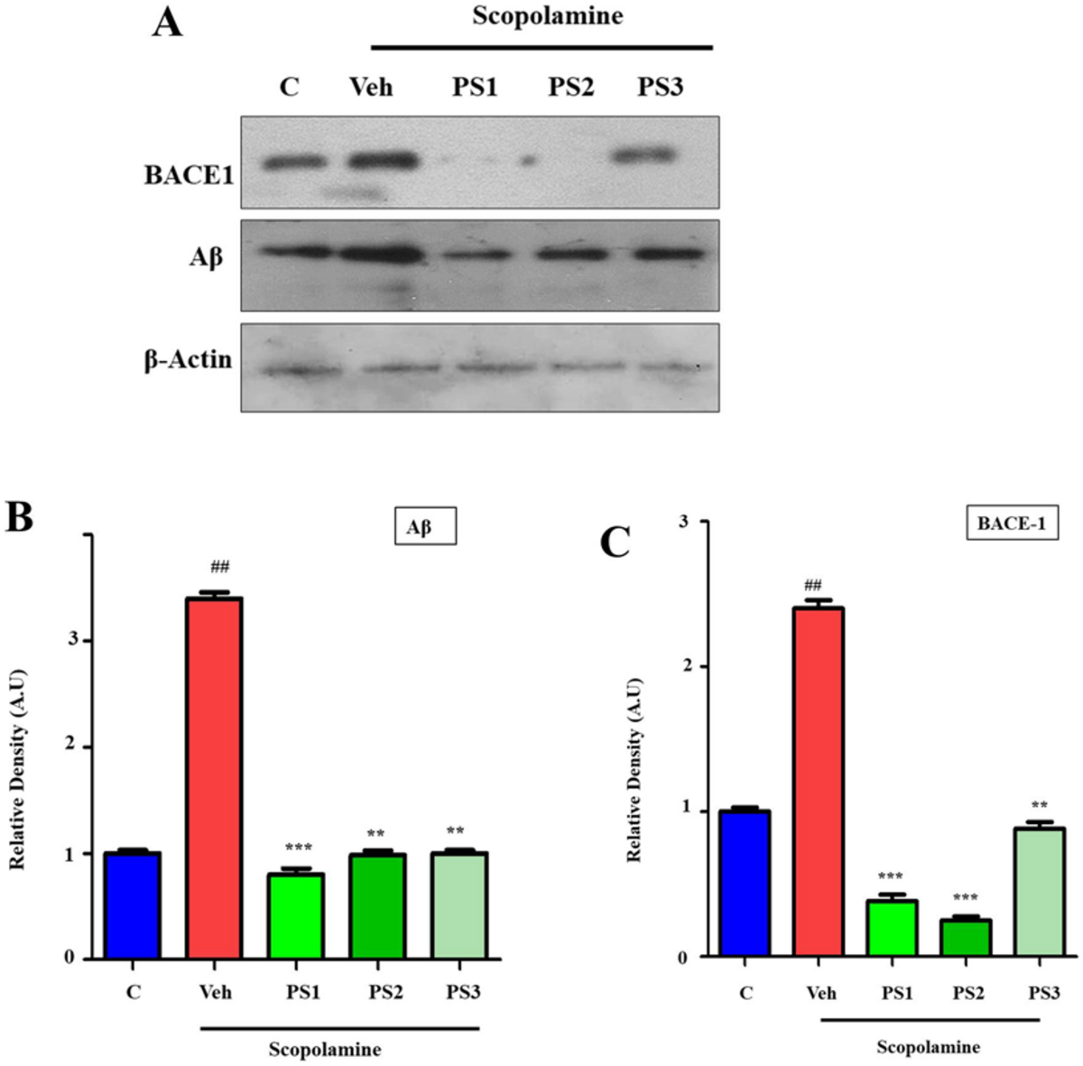 Macroalgae Polysaccharides Enhance Brain Health by Mitigating  Scopolamine-induced Oxidative Stress and Inflammation Via Nrf-2/TLR4/NF-kB  Pathways | Journal of Neuroimmune Pharmacology, image size:1200x1181