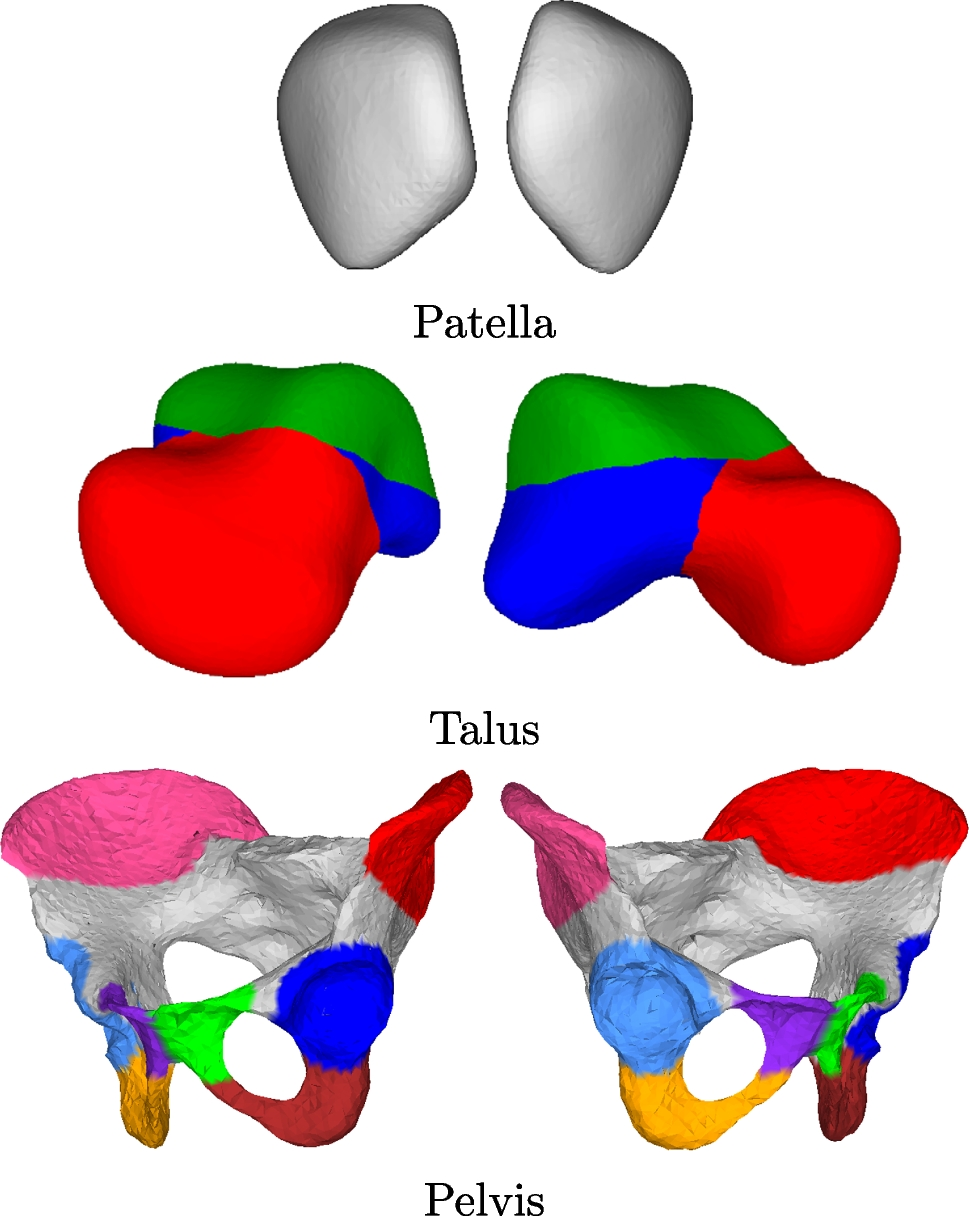 3D biplanar reconstruction of lower limbs using nonlinear statistical  models | Medical & Biological Engineering & Computing | Springer Nature Link