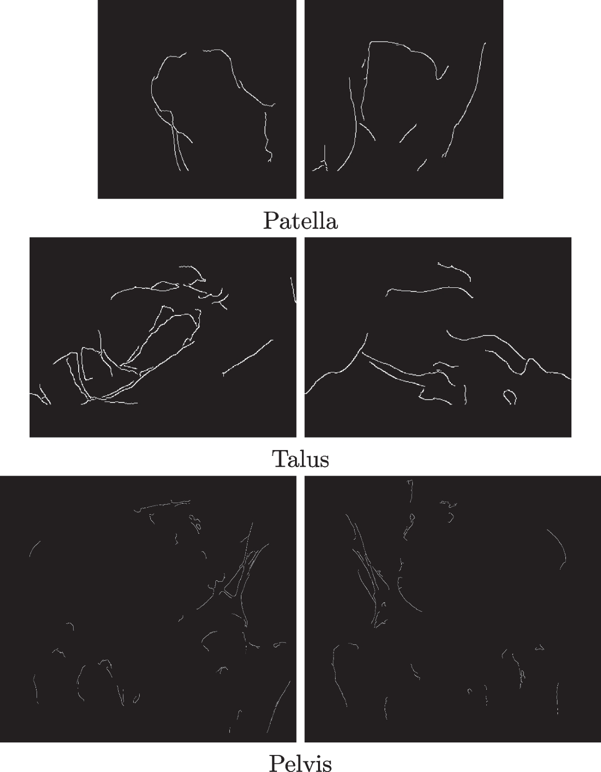 3D biplanar reconstruction of lower limbs using nonlinear statistical  models | Medical & Biological Engineering & Computing | Springer Nature Link