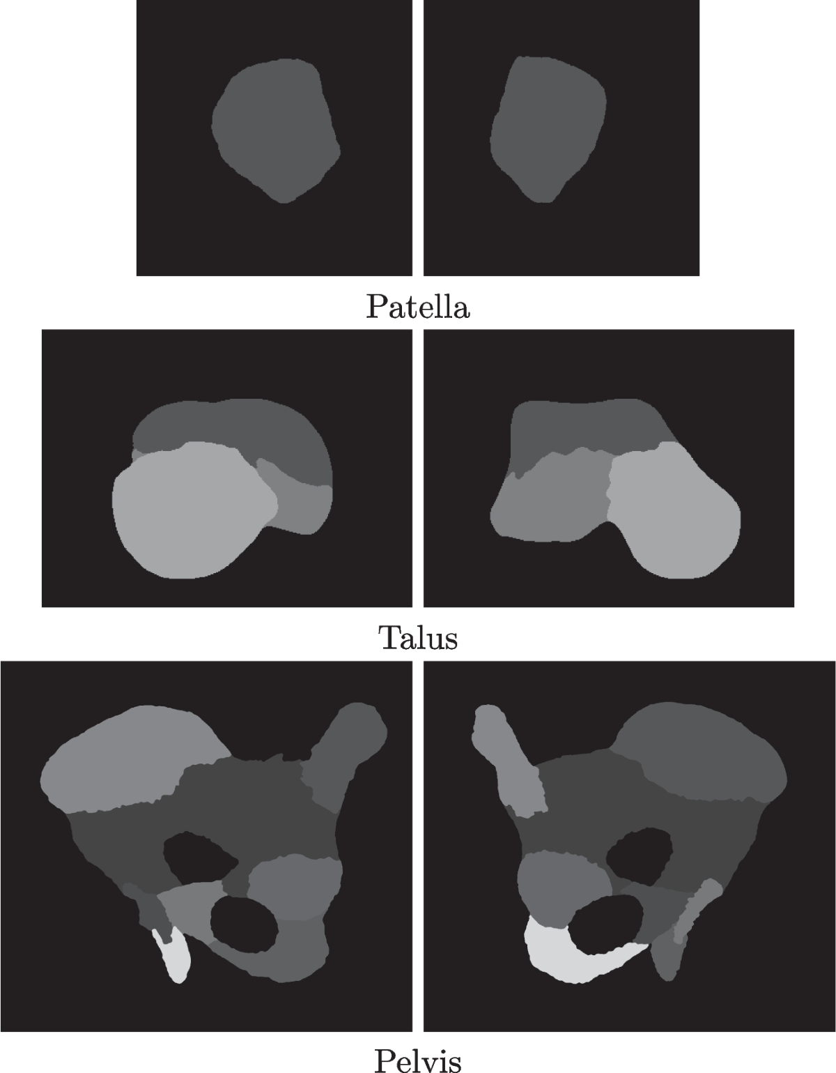 3D biplanar reconstruction of lower limbs using nonlinear statistical  models | Medical & Biological Engineering & Computing | Springer Nature Link
