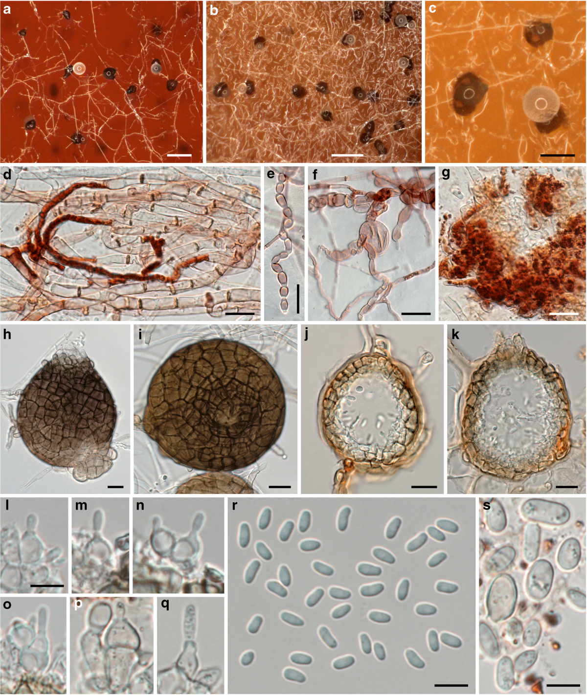 Didymella corylicola sp. nov., a new fungus associated with hazelnut fruit  development in Italy | Mycological Progress | Springer Nature Link