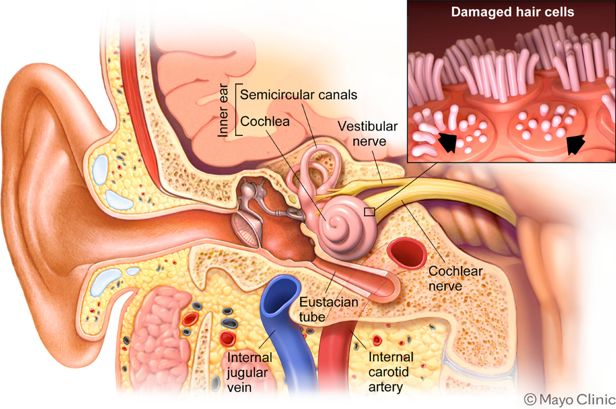 Pulsatile Tinnitus: Differential Diagnosis and Approach to Management | Current Pain and Headache Reports