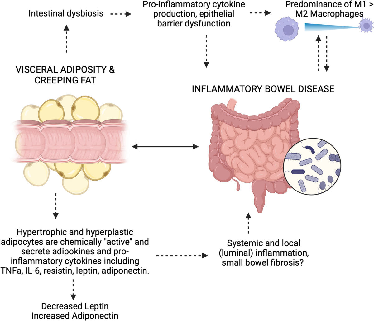 The Rising Epidemic of Obesity in Patients with Inflammatory Bowel Disease  | Current Treatment Options in Gastroenterology