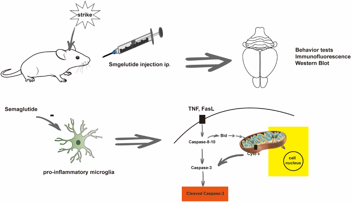 semaglutide cognitive function Semaglutide Inhibits Neuronal Apoptosis and Improves Cognitive Function in  Mice after Traumatic Brain Injury, Mainly via the Caspase-Dependent Pathway  | Neurocritical Care