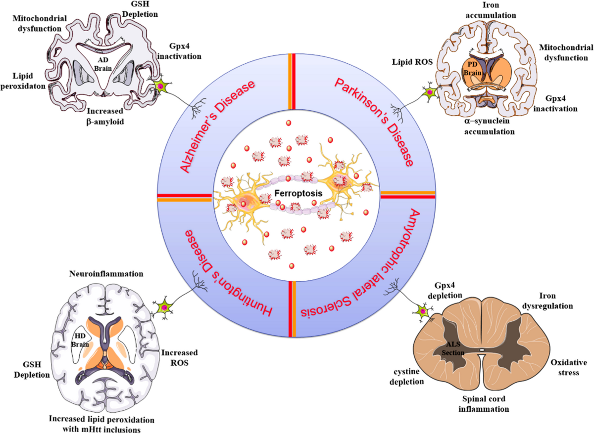 glutathione stransferase mu 1 Glutathione S-transferase