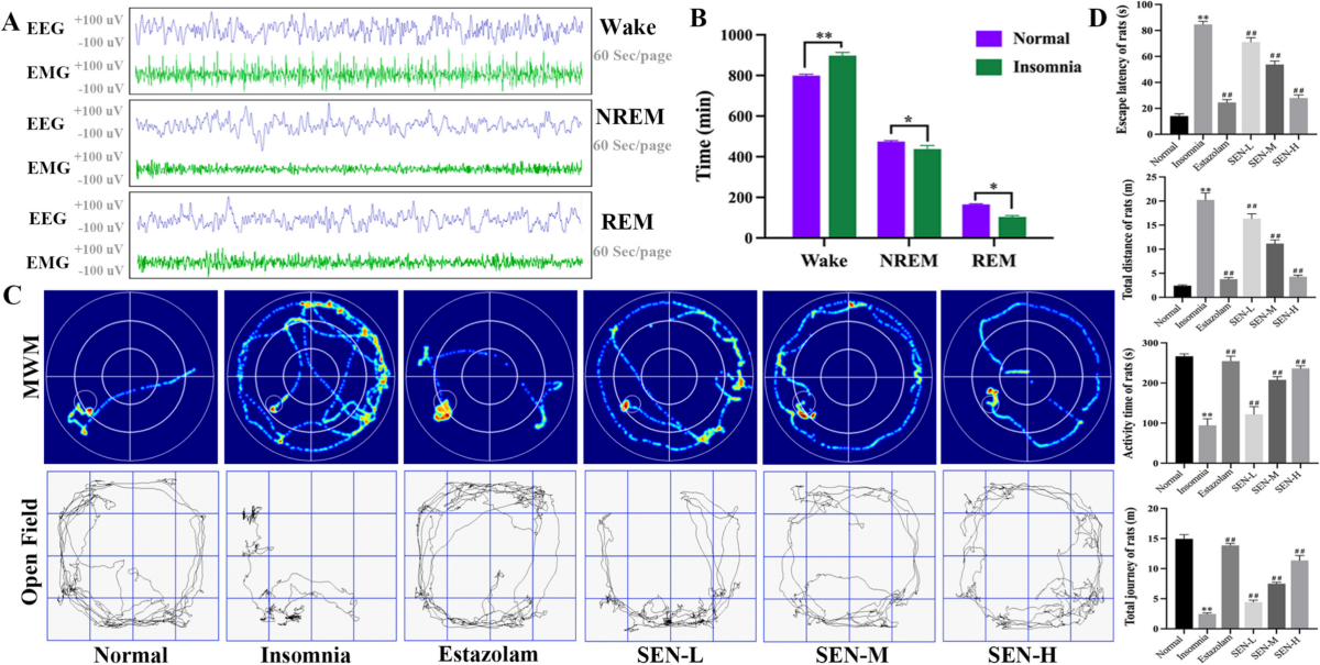 Mechanisms of Senegenin in Regulating Oxidative Stress and Mitochondria Damage for Neuroprotection in Insomnia: Evidence from In Vivo and In Vitro Models | Molecular Neurobiology