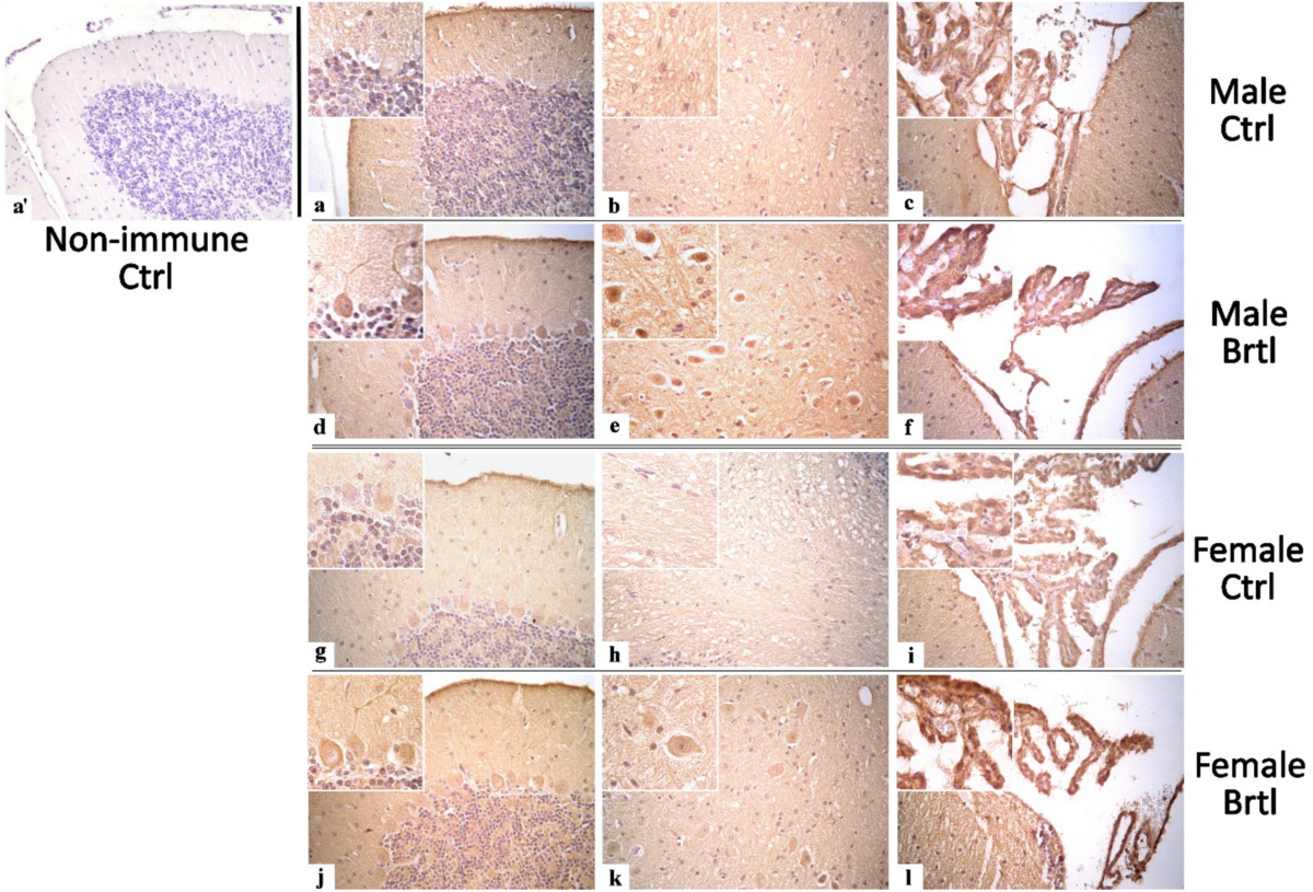 0 56 bitcoin em brtl (90) 사진