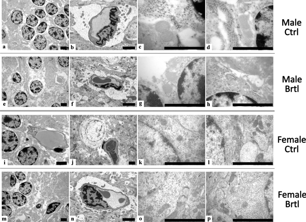 Osteogenesis Imperfecta: A Look into the Cerebellum of the Brtl Murine  Model | Molecular Neurobiology | Springer Nature Link