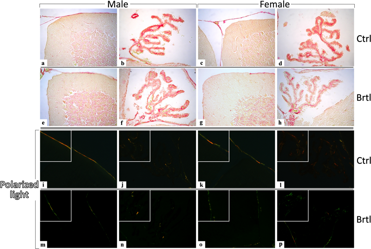 Osteogenesis Imperfecta: A Look into the Cerebellum of the Brtl Murine  Model | Molecular Neurobiology | Springer Nature Link