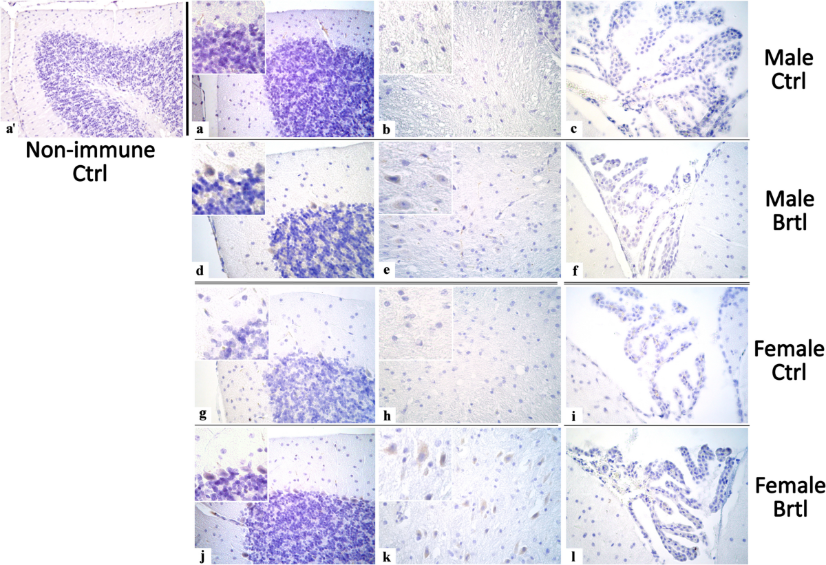 Osteogenesis Imperfecta: A Look into the Cerebellum of the Brtl Murine  Model | Molecular Neurobiology | Springer Nature Link