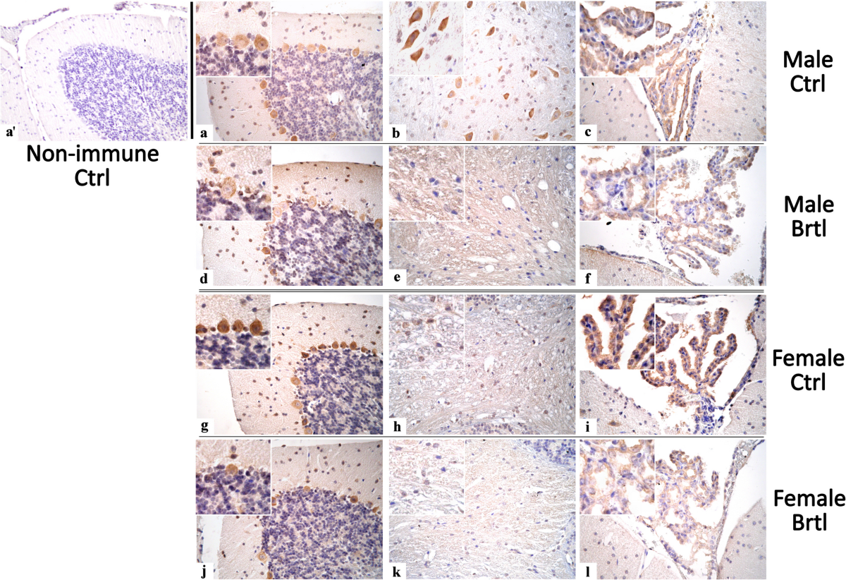 Osteogenesis Imperfecta: A Look into the Cerebellum of the Brtl Murine  Model | Molecular Neurobiology | Springer Nature Link