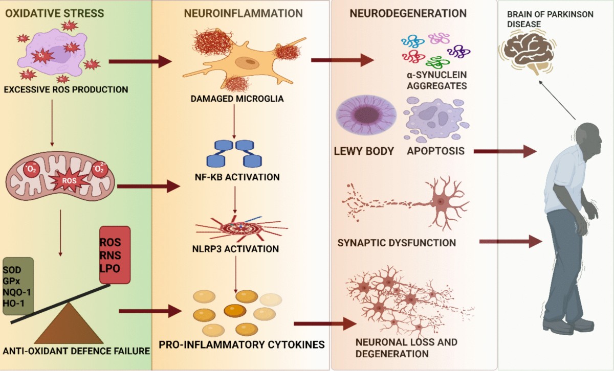 facts about glutathione and parkinson's disease Amazon.com: BulkSupplements.com Glutathione Reduced Powder - Glutathione  Supplement, Reduced Glutathione Powder main image 0