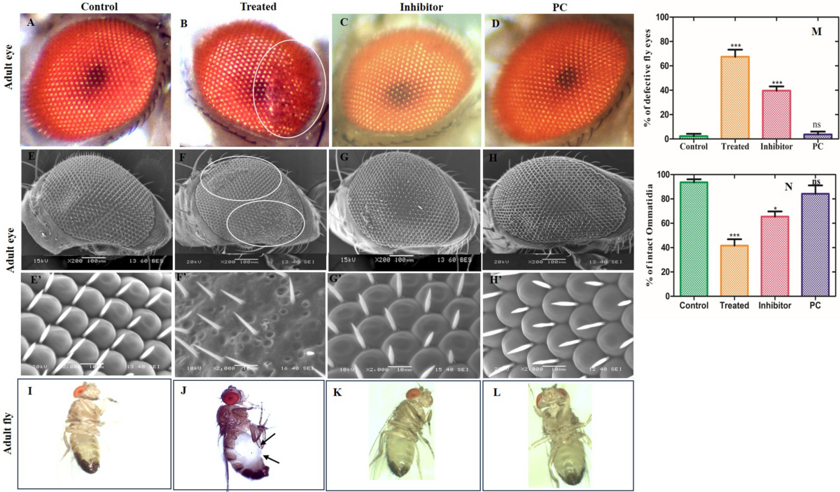Unravelling the Mechanism of N-Acetylcysteine in Alleviating Smoke-Induced Hypoxia-Driven Ocular Defects in Drosophila melanogaster | Molecular Neurobiology