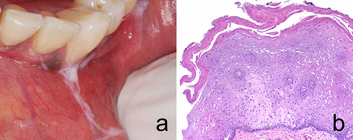 can smokeless tobacco cause breathing problems Hazards of Smokeless Tobacco