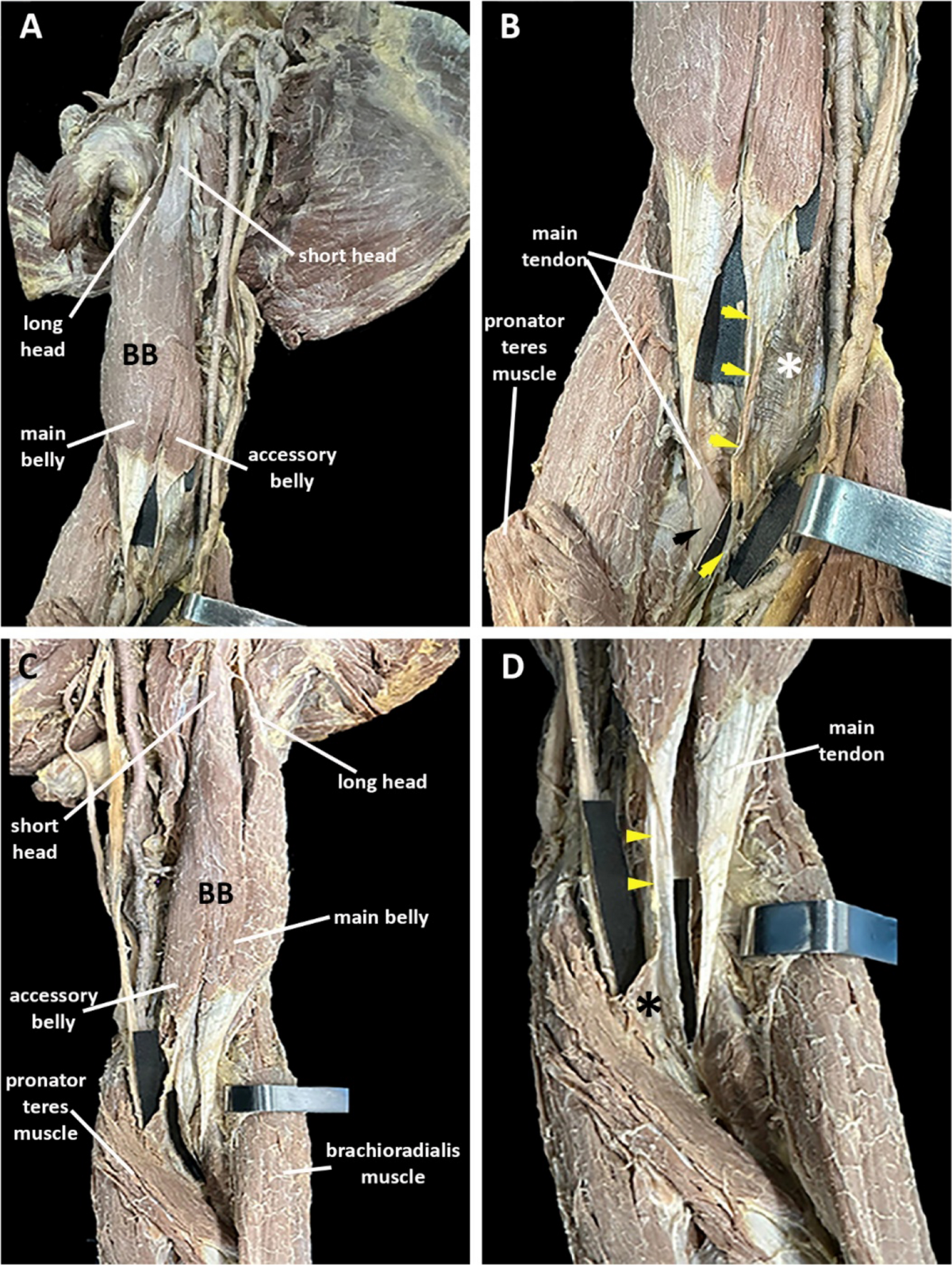 PPT - STRUCTURES OF THE ARM PowerPoint Presentation, free download -  ID:5615085, image size:1200x1594