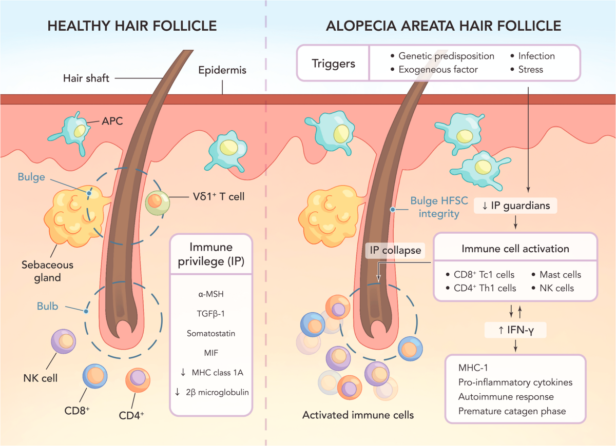 Targeting the Gut Microbiota with Pro- and Postbiotics: Emerging Strategies against Alopecia | Probiotics and Antimicrobial Proteins | Springer Nature Link Targeting the Gut Microbiota with Pro- and Postbiotics: Emerging Strategies against Alopecia | Probiotics and Antimicrobial Proteins | Springer Nature Link