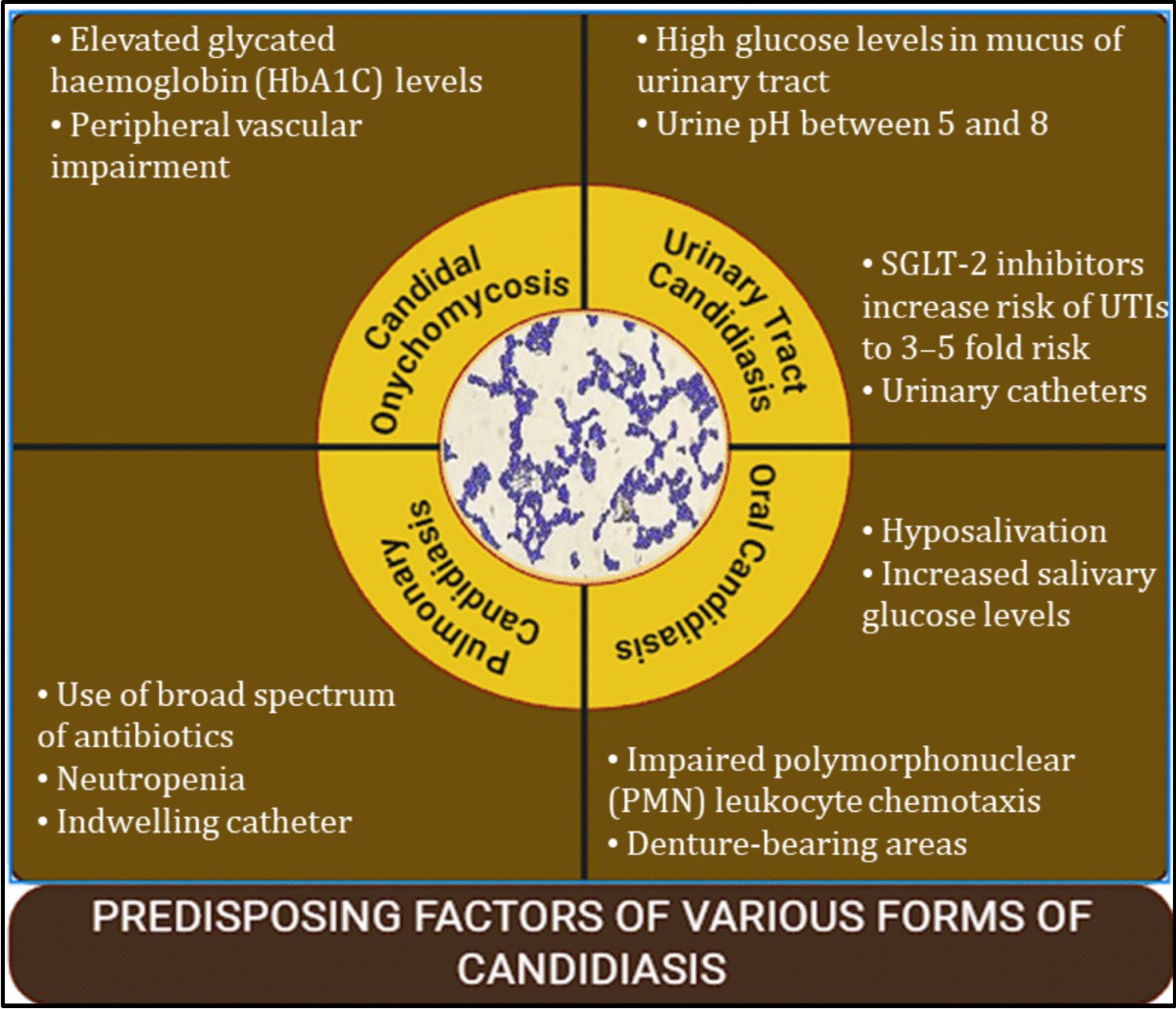 does glutathione kill candida Nano-Enhanced Antifungal Therapy in Diabetic Patients with Candidiasis |  BioNanoScience