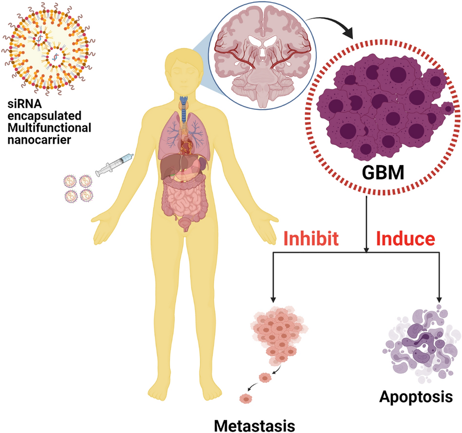 jb nude budding girls Multifunctional nanocarriers for delivering siRNA and miRNA in glioblastoma  therapy: advances in nanobiotechnology-based cancer therapy | 3 Biotech