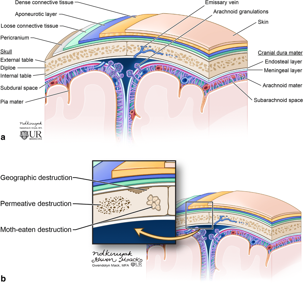 Radiological review of skull lesions | Insights into Imaging
