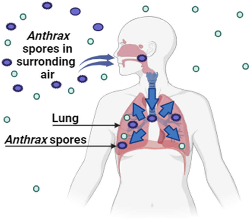 Which Clinical Manifestation is Associated With Inhalation Anthrax: Key Symptoms Explained
