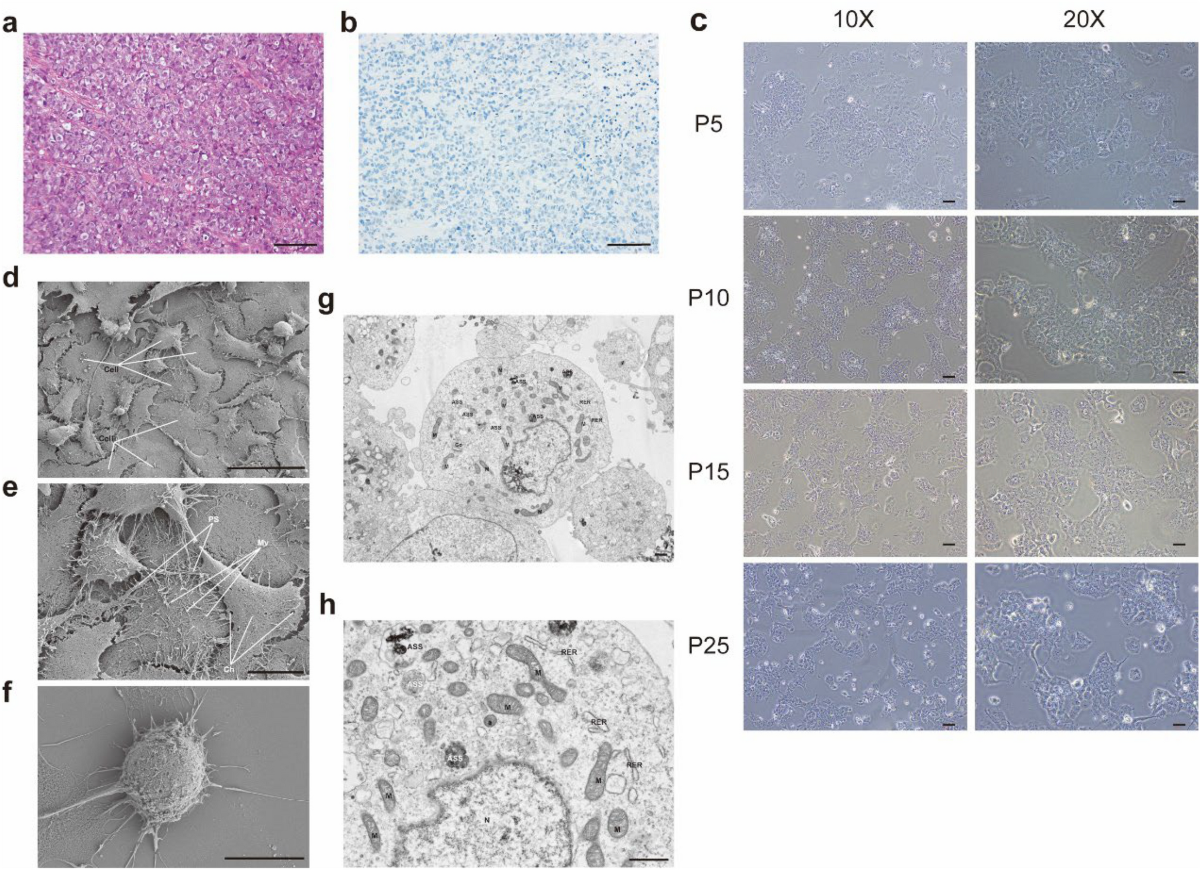 Establishment and characterization of a novel cell line (SCCOHT-CH-1) and PDX models derived from Chinese patients of small cell ovarian carcinoma of the hypercalcemic type | Human Cell