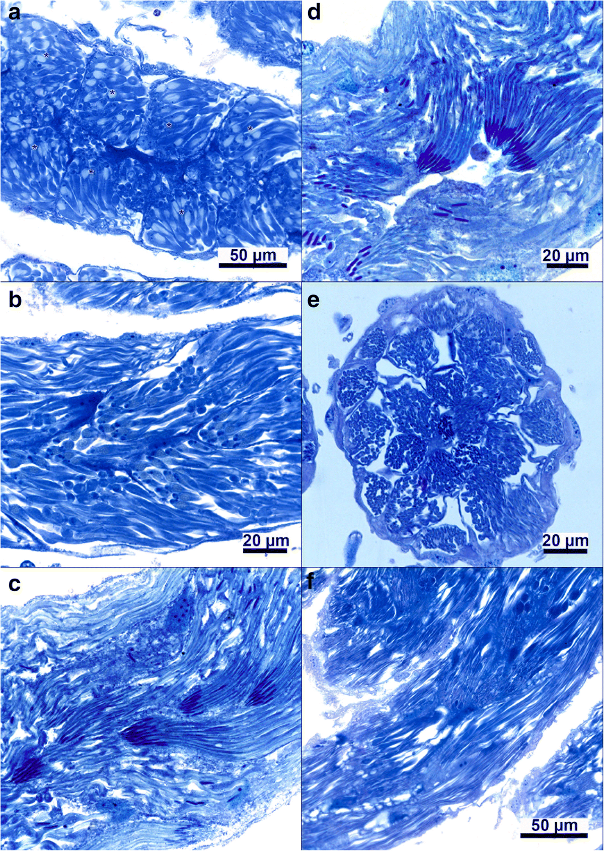 darkpd porn gif Testis development and spermatogenesis in drones of the honey bee, Apis mellifera L. | Apidologie