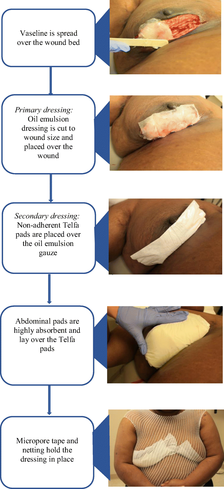moisture-retaining dressing Hydrocolloid Dressing for First & Second-Degree Burns