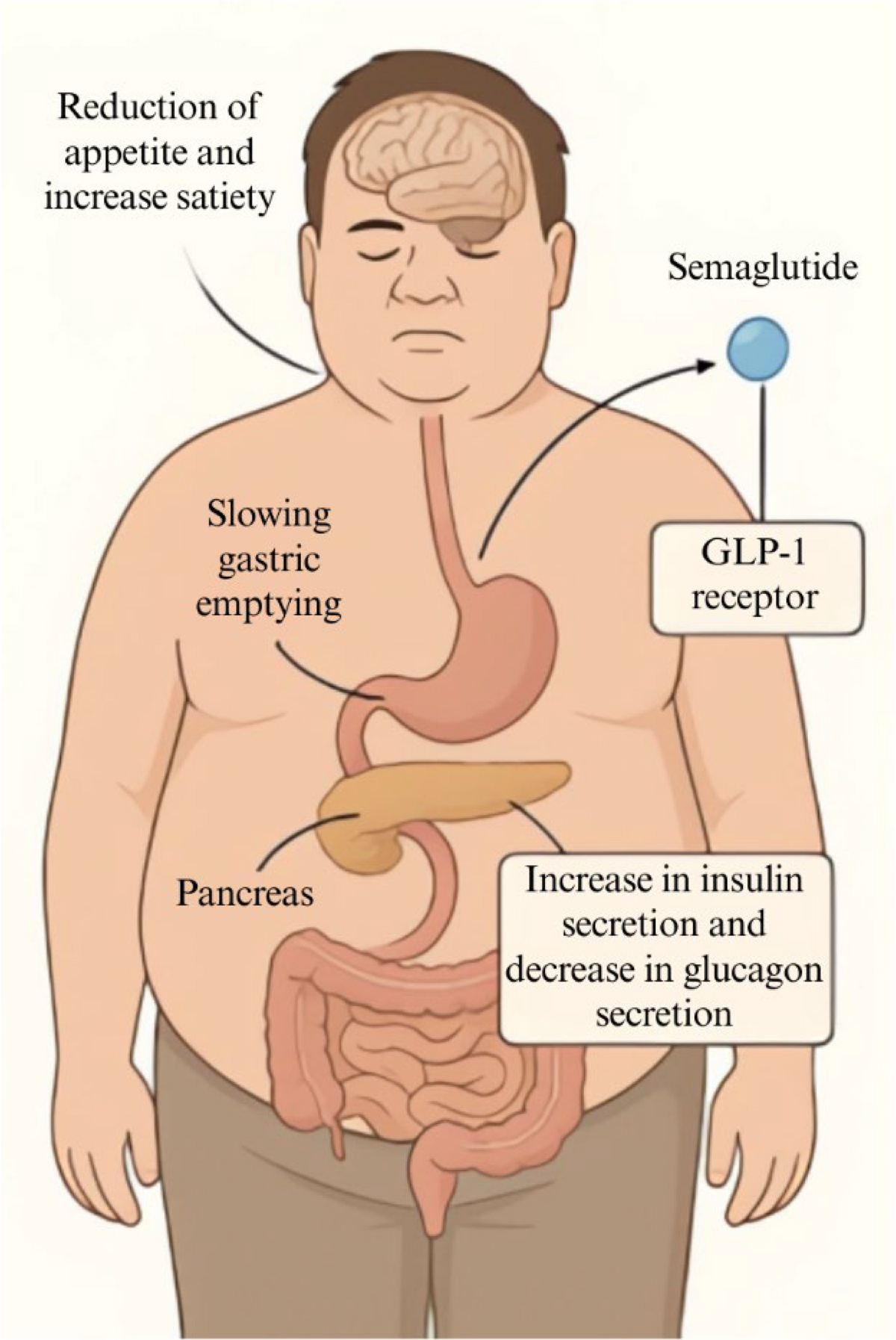 semaglutide and ghrelin A Multidisciplinary Perspective on Semaglutide Treatment and Medical  Nutrition Therapy in Obesity Management | Current Obesity Reports