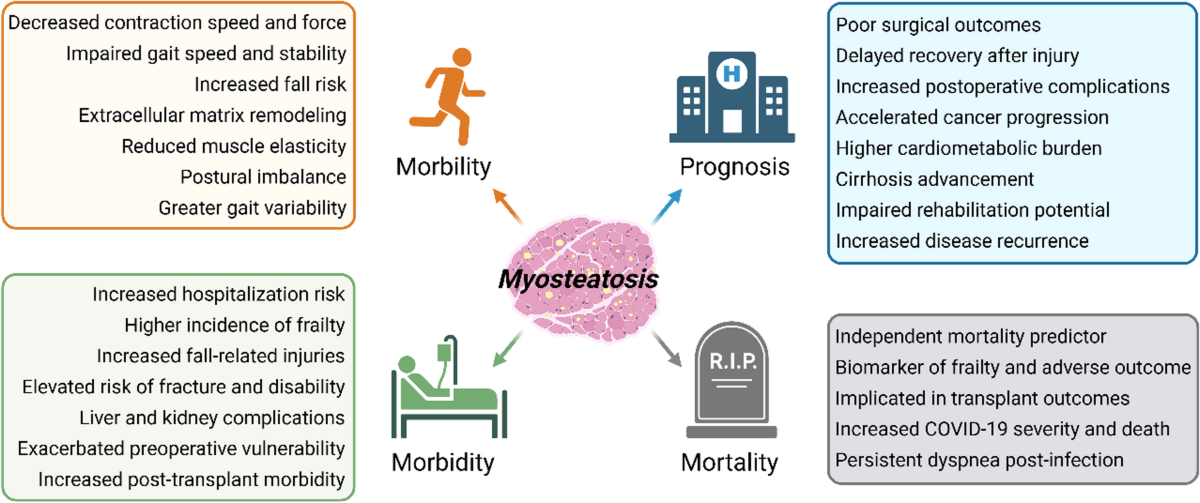 Myosteatosis: Epidemiological Insights, Functional Decline, and Diagnostic  Advances | Current Obesity Reports