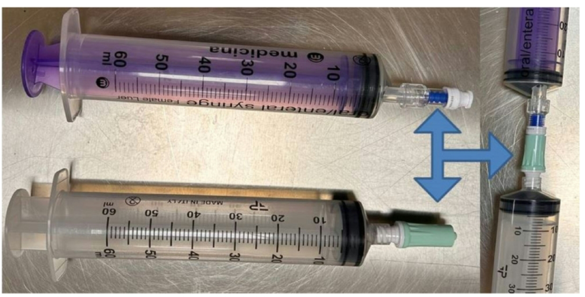 how to inject glutathione using butterfly syringe Italian association of nuclear medicine molecular imaging and therapy (AIMN) practical guide on white blood cells labelling for imaging infections and inflammations: technical procedure, quality controls and national regulations Zooki Liposomal Glutathione 500mg Tribedoce Dx Treatment Packages:2