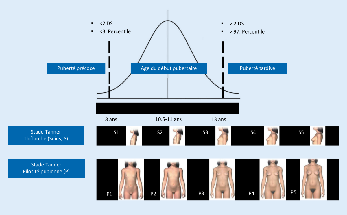 Hommes, garçons, et troubles alimentaires | boulimie.quebec, image size:1200x744