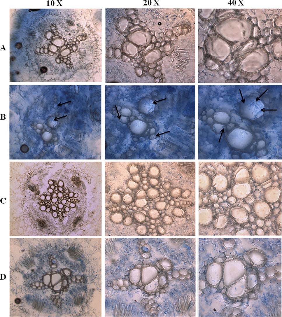LCM-based xylem-specific RNA extraction from Fusarium oxysporum infected  Cicer arietinum roots | Journal of Plant Pathology