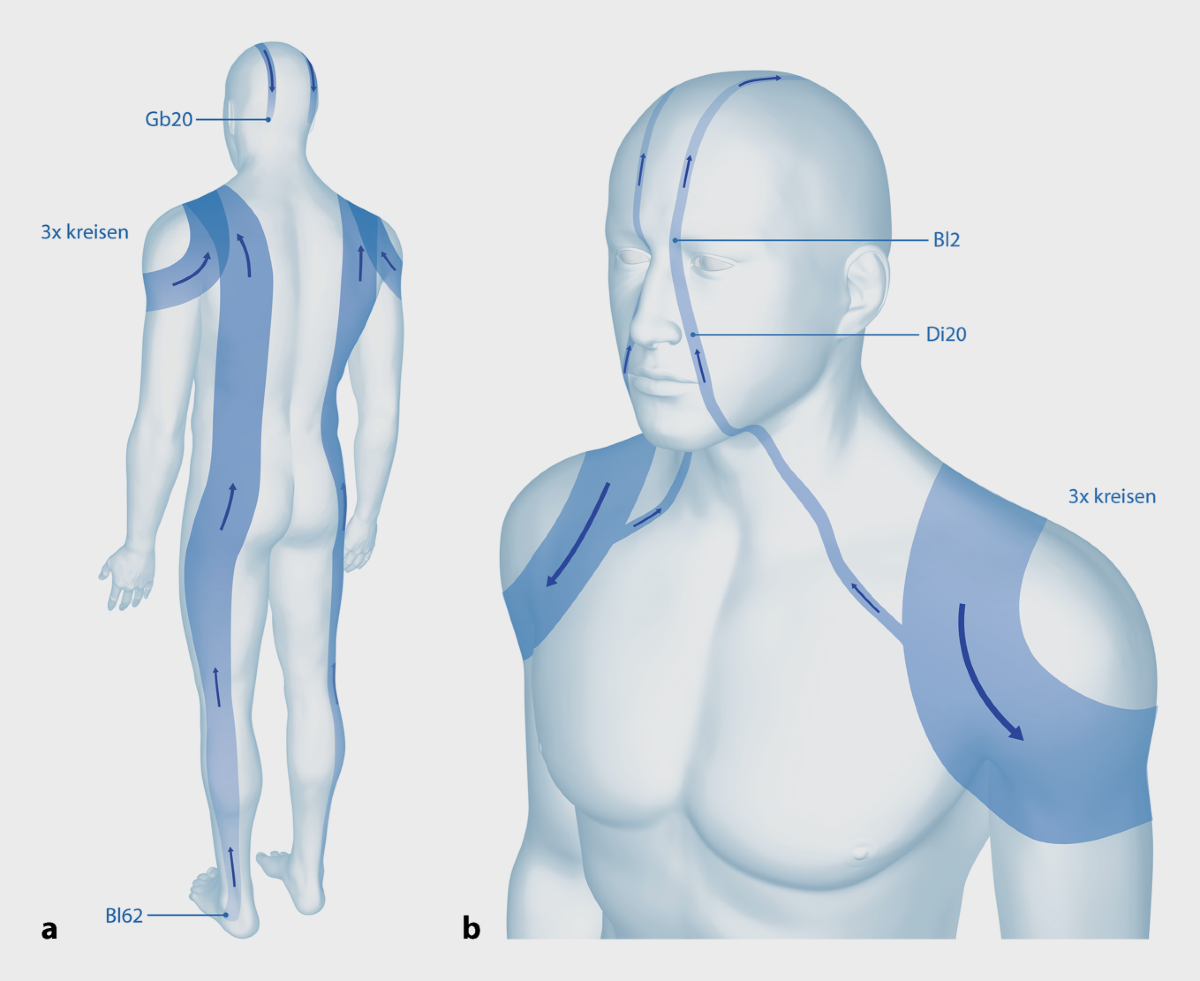 Rückenbeschwerden und aufrechte Haltung | Deutsche Zeitschrift für  Akupunktur, image size:1200x981