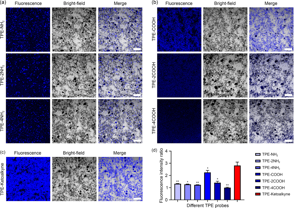 Uric Acid Crystals Watercolor Print - 5x7 Inches / No (+$0), image size:1200x849