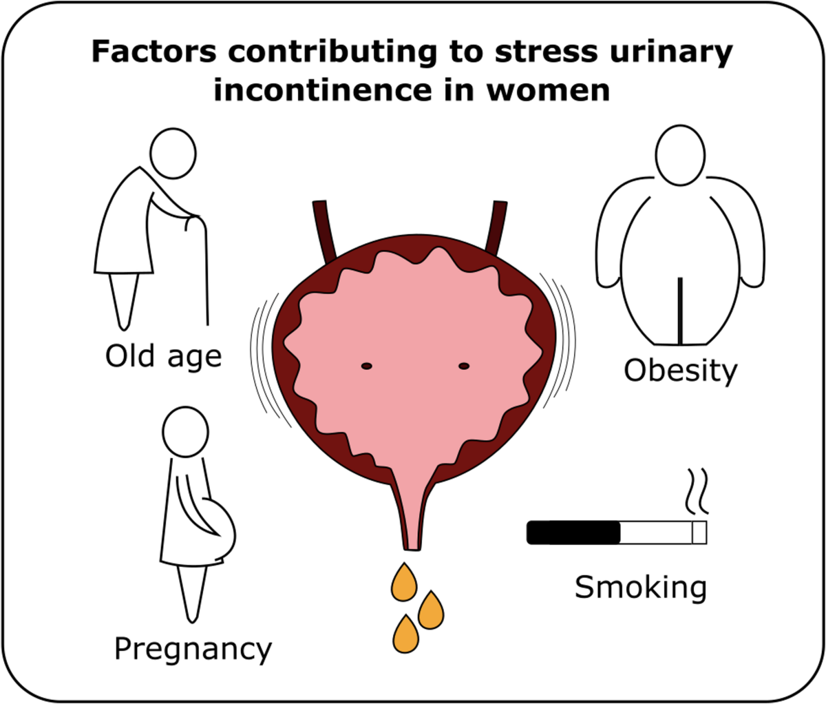 Understanding Risk Factors for Stress Urinary Incontinence in 