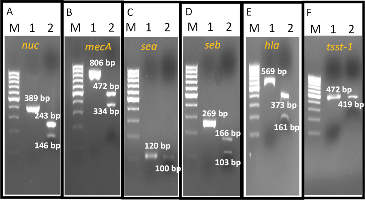Optimization and evaluation of a multiplex PCR assay for detection of  Staphylococcus aureus and its major virulence genes for assessing food  safety | Brazilian Journal of Microbiology